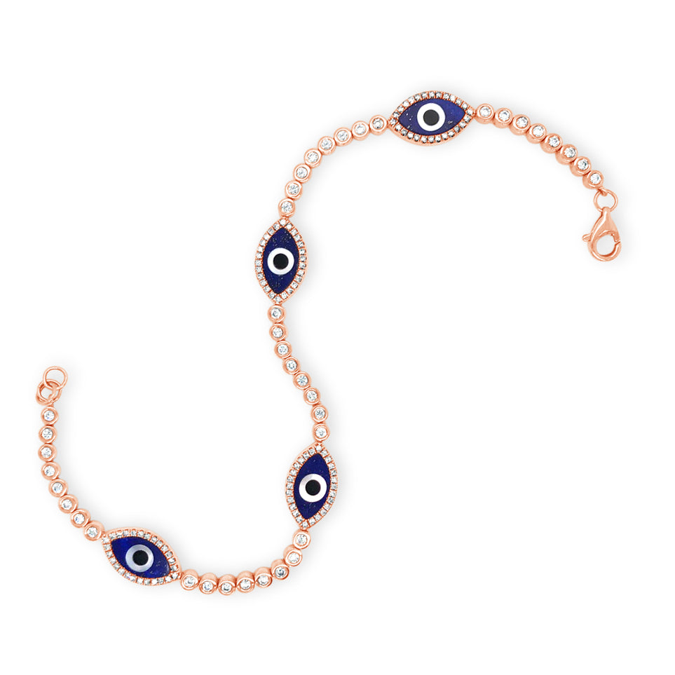 Amazon.com: 14k Gold Evil Eye Bracelet - Blue Evil Eye Rolo Chain - Real  Solid Gold Eye Station for Ultimate Protection - Great Gift for Women and  Girls : Handmade Products